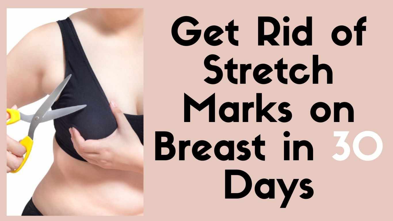 get-rid-of-stretch-marks-on-breast-in-30-days-facts